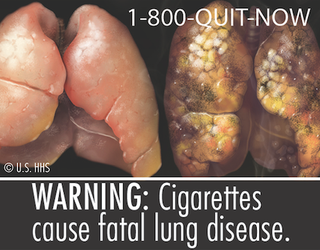 Illustration for article titled All the Disgusting Pictures the FDA Is Going to Put on Cigarette Boxes